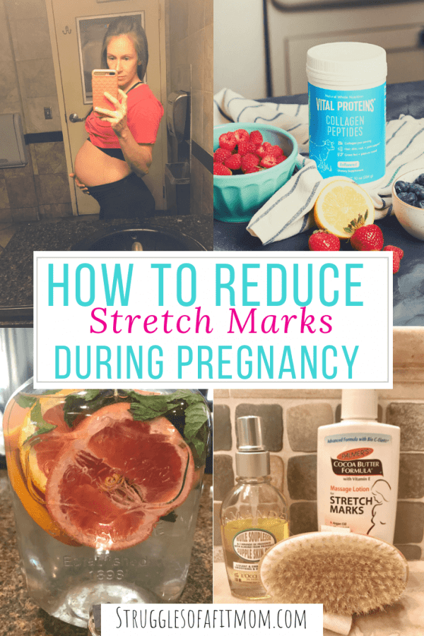The best products to help prevent stretch marks during pregnancy