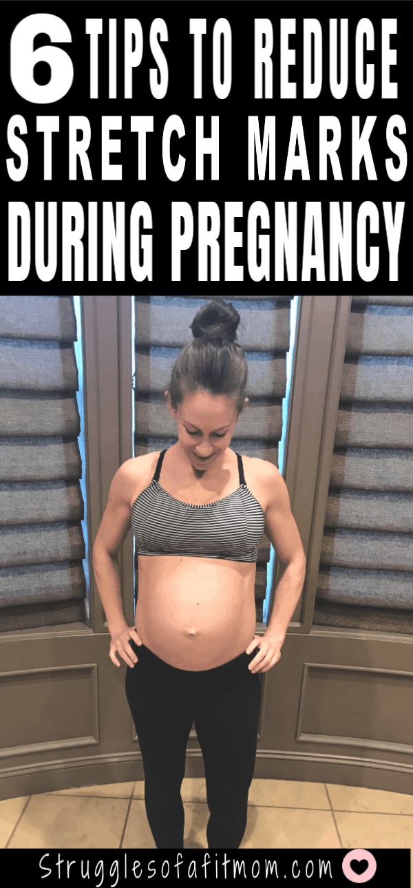 How to prevent stretch marks during pregnancy