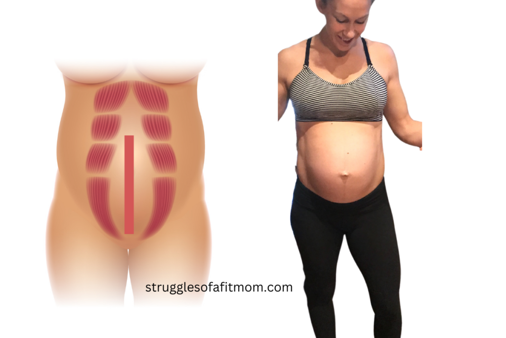 pregnant mom looking down at her belly. she is wearing black and white striped sports bra and black leggings. next to her is a picture of abdominal separating during pregnancy