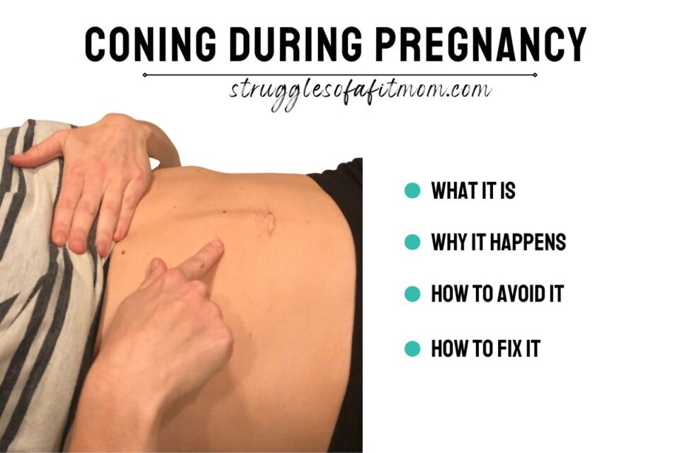 Abdominal Coning During Pregnancy-The Cause and Solution - Struggles of