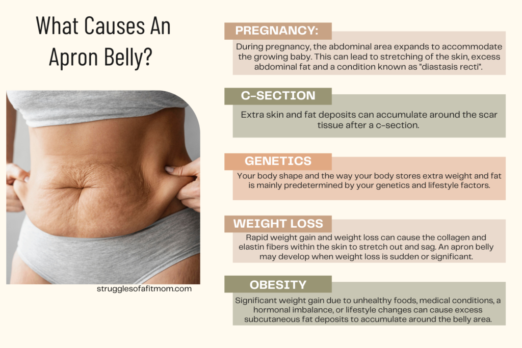 Mommy Tummy Explained: Overhang vs The Pooch