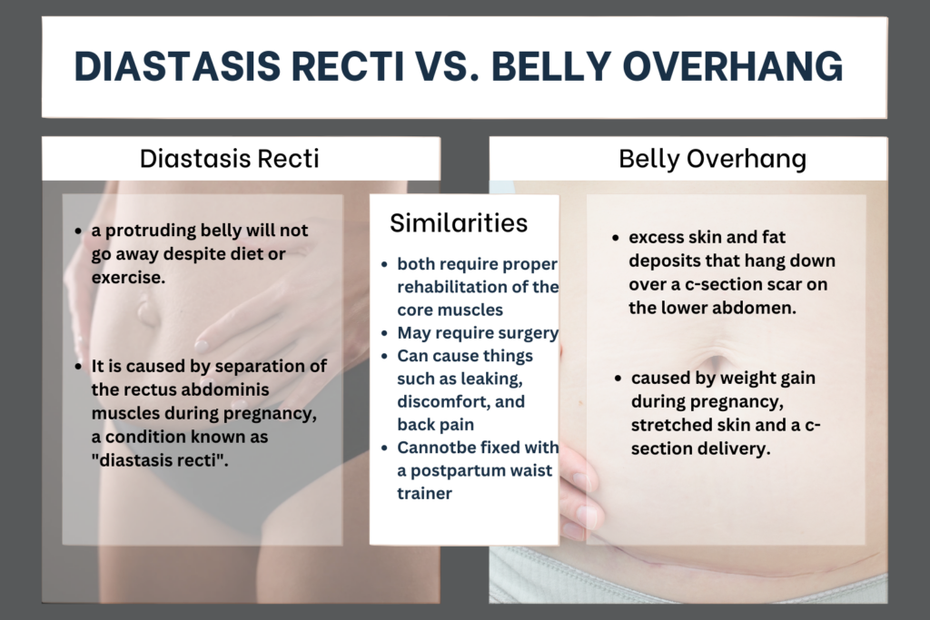 infographic difference between diastasis recti and c-section pooch