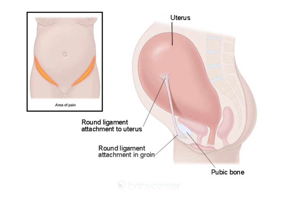 anatomy and location of round ligaments during pregnancy