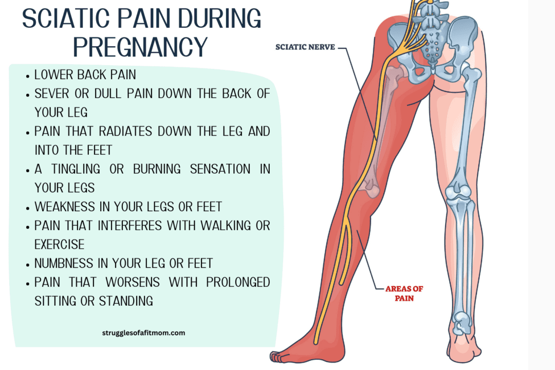 Don't Let Sciatica Ruin Your Pregnancy! 28 Tips For Relief