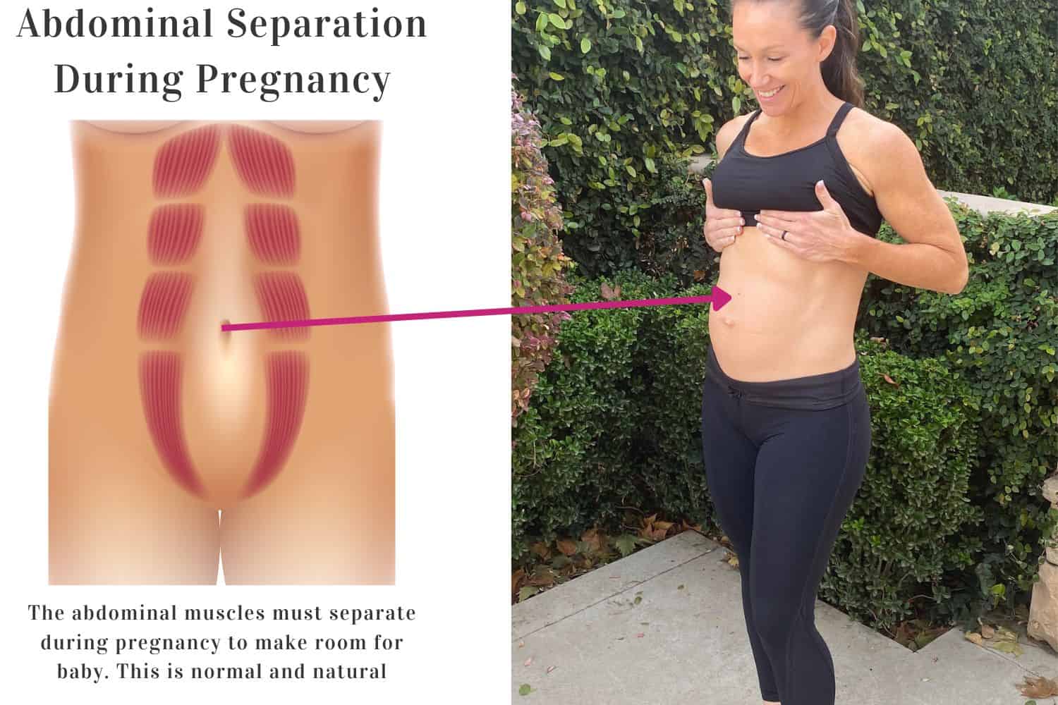 fit pregnant mom showing her stomach for an example of diastasis recti during pregnancy